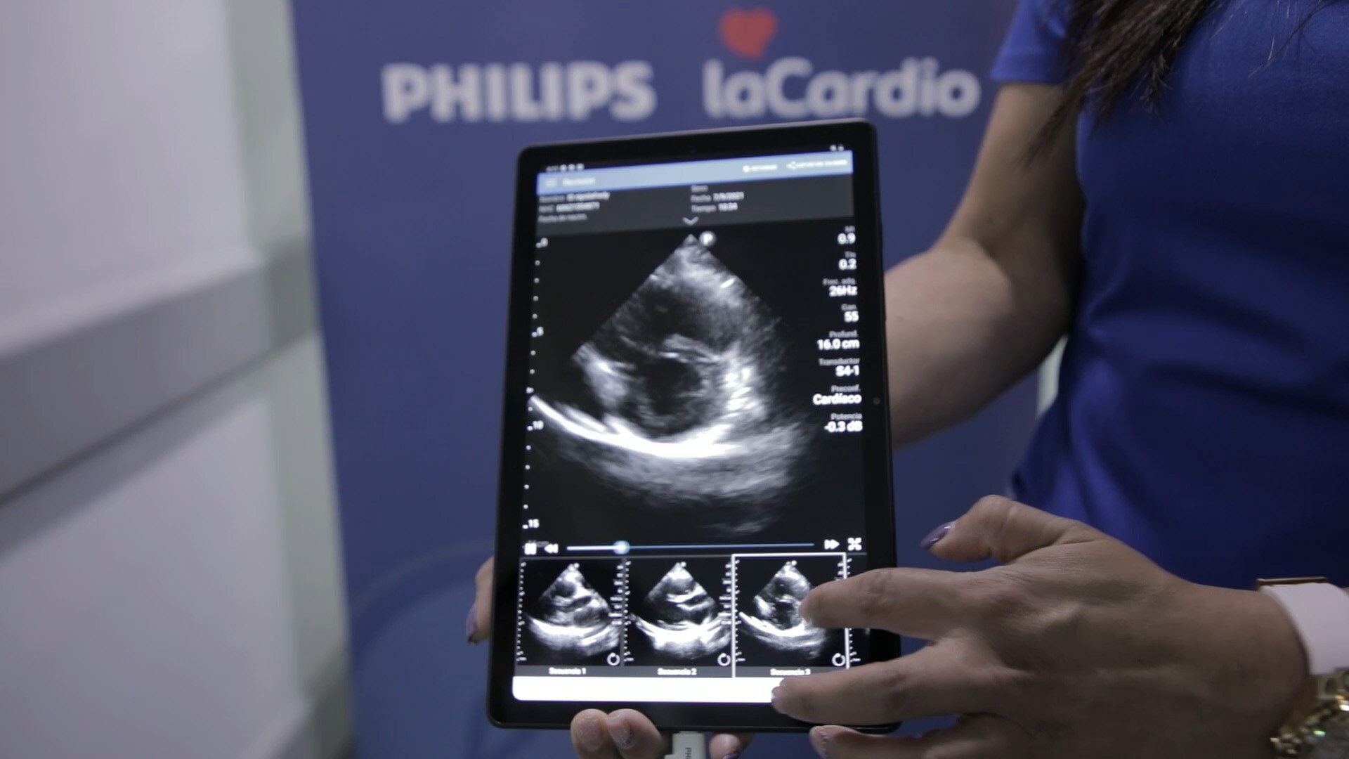 echocardiography-YOUTUBE 
