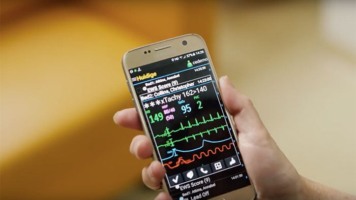 Uso de dispositivos móviles para administrar alarmas de monitoreo con el video Philips CareEvent