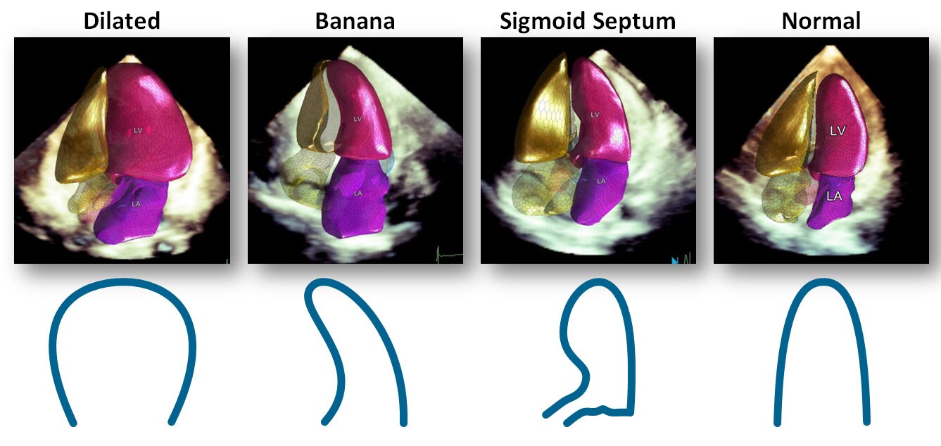 clinical image