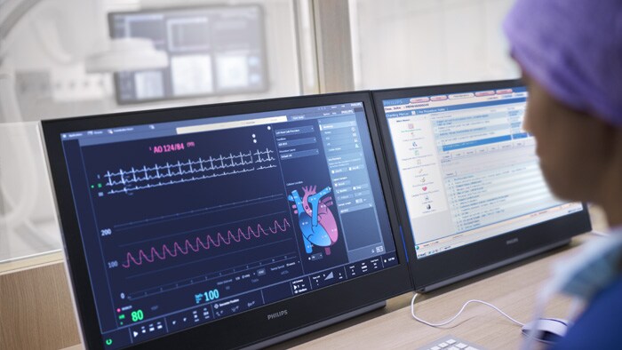 Hemodinamia con la estación de trabajo IntelliVue