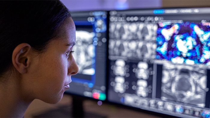 Descubra las ventajas que MR Workspace puede aportar a su servicio de radiolog&iacute;a