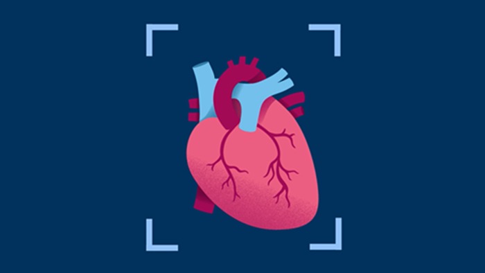 Vídeo del Cardiac CT 5300