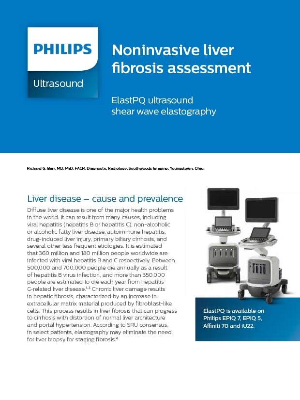 ElastPQ ultrasound shear wave elastography