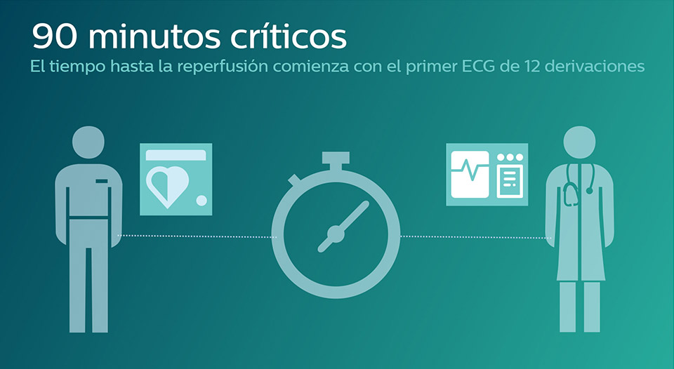 Apoya la misi&oacute;n de 90 minutos con herramientas para ayudar a los m&eacute;dicos a aplicar la terapia de IAMCEST de manera r&aacute;pida
