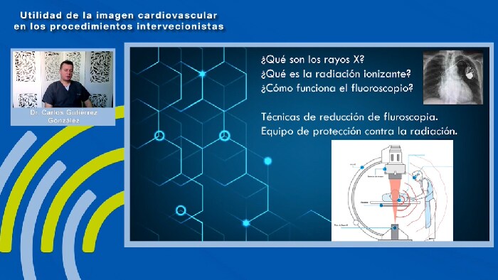 Buenas prácticas en el uso de la Fluoroscopia en la sala de Electrofisiología cardiaca – Dr. Carlos Gutierrez González