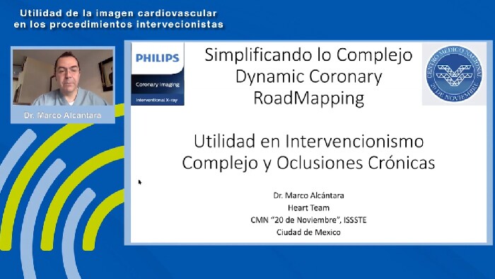 Mire este Webinar en YouTube