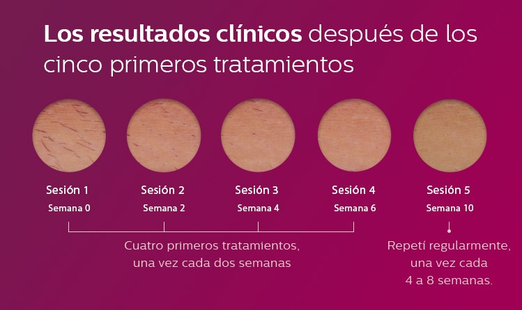 Los resultados clínicos después de los cinco primeros tratamientos