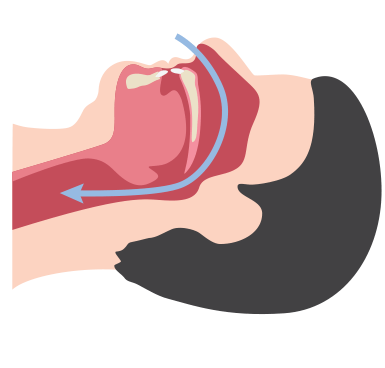 Vías respiratorias no obstruidas y obstruidas