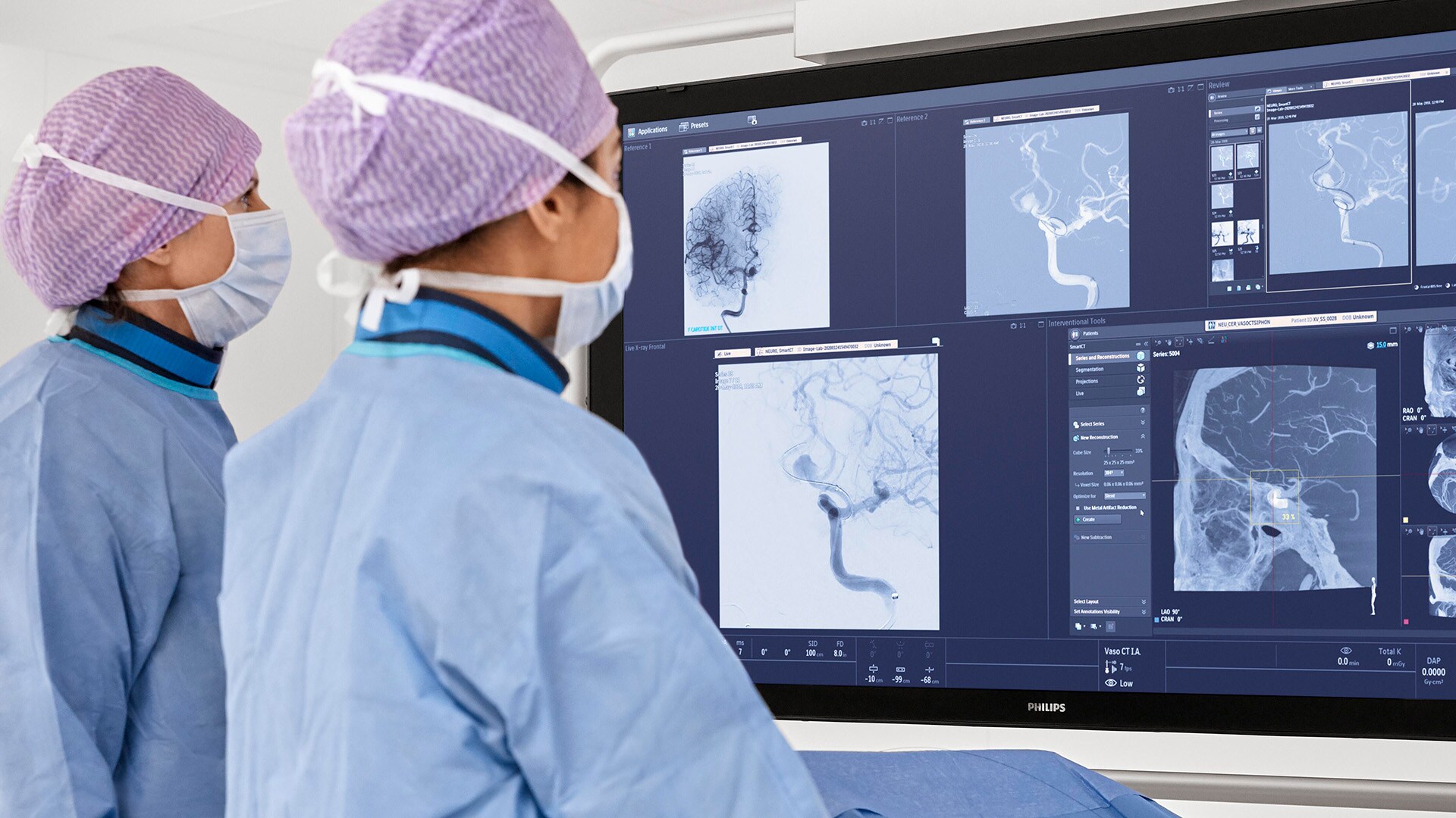 Resultados anuales y del cuarto trimestre de Philips 2022