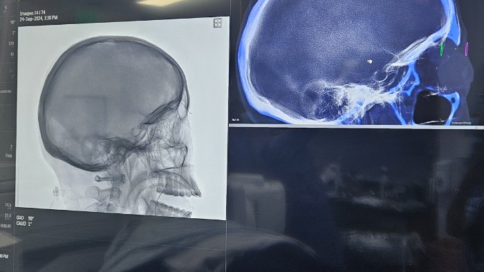 image-guided-neurological