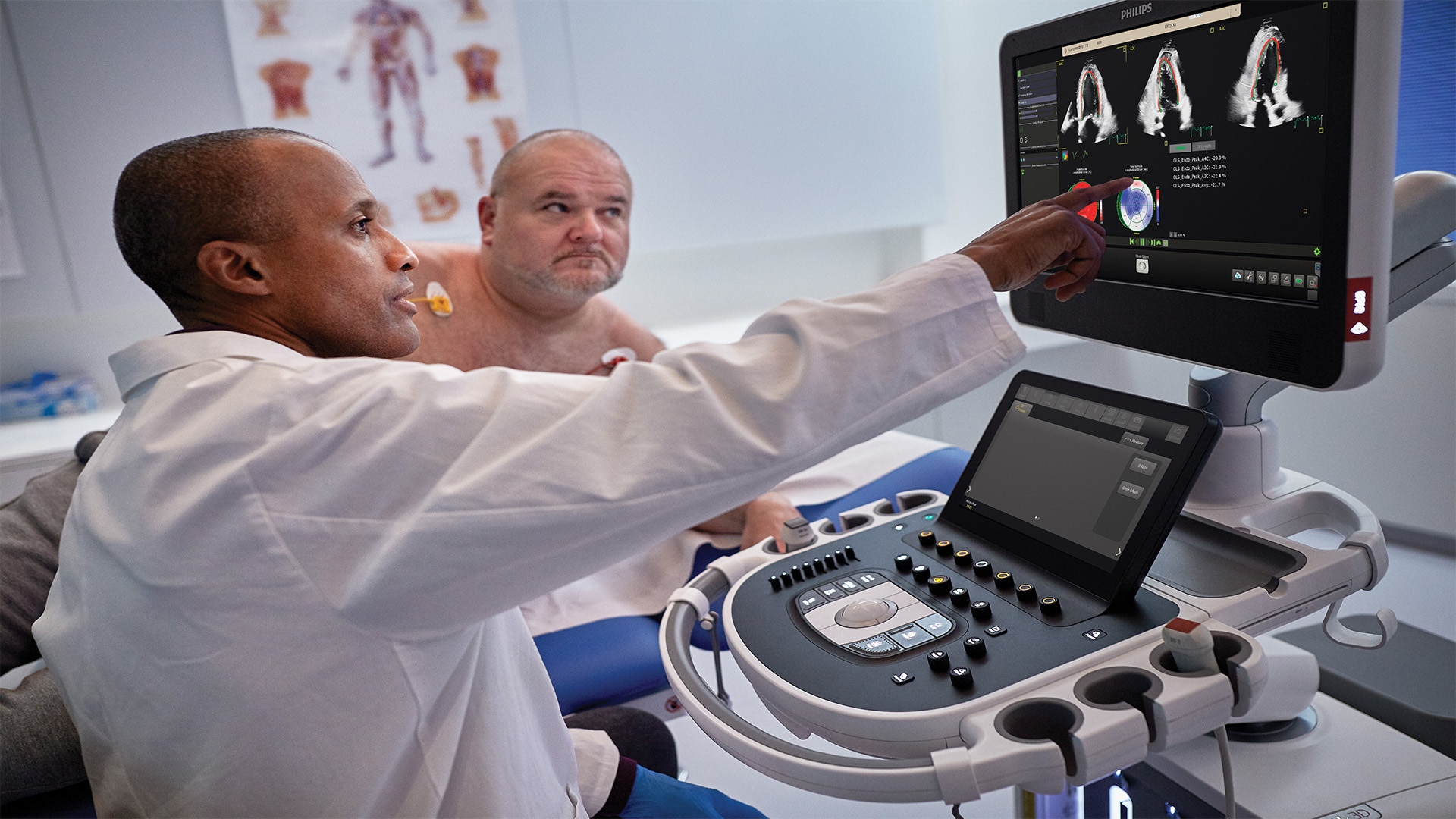 Integración profunda de herramientas de IA probadas en los sistemas de ultrasonido cardiovascular de Philips para mejorar los diagnósticos para más pacientes con enfermedades cardíacas