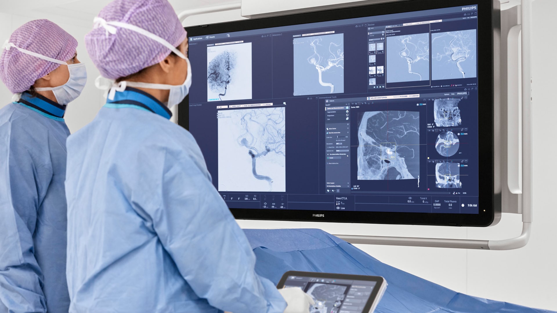 Philips está priorizando la atención del accidente cerebro vascular a nivel mundial.
