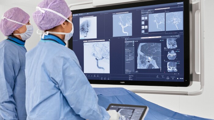 Philips está priorizando la atención del accidente cerebro vascular a nivel mundial.